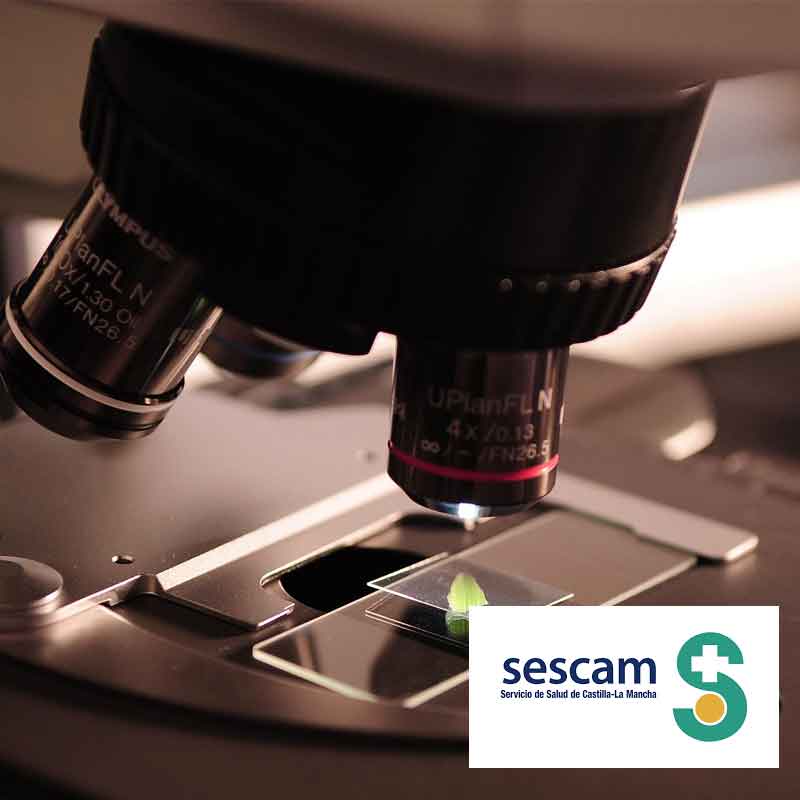 prepara la oposicion de anatomia patologica para el Sescam