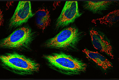 5 Curiosidades sobre el Microscopio que Desconocías
